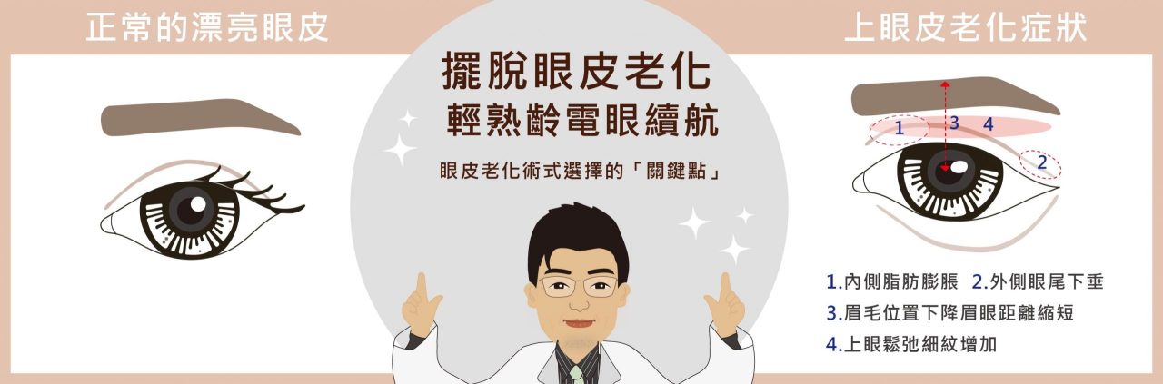 上眼皮的老化特徵是什麼?什麼情況需要做提眉手術?