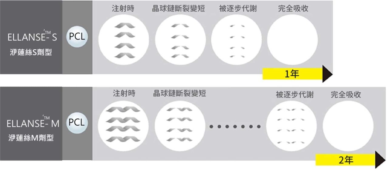 Ellanse洢蓮絲S型與M型劑型維持時間圖 - 顯示S型維持1年、M型維持2年效果