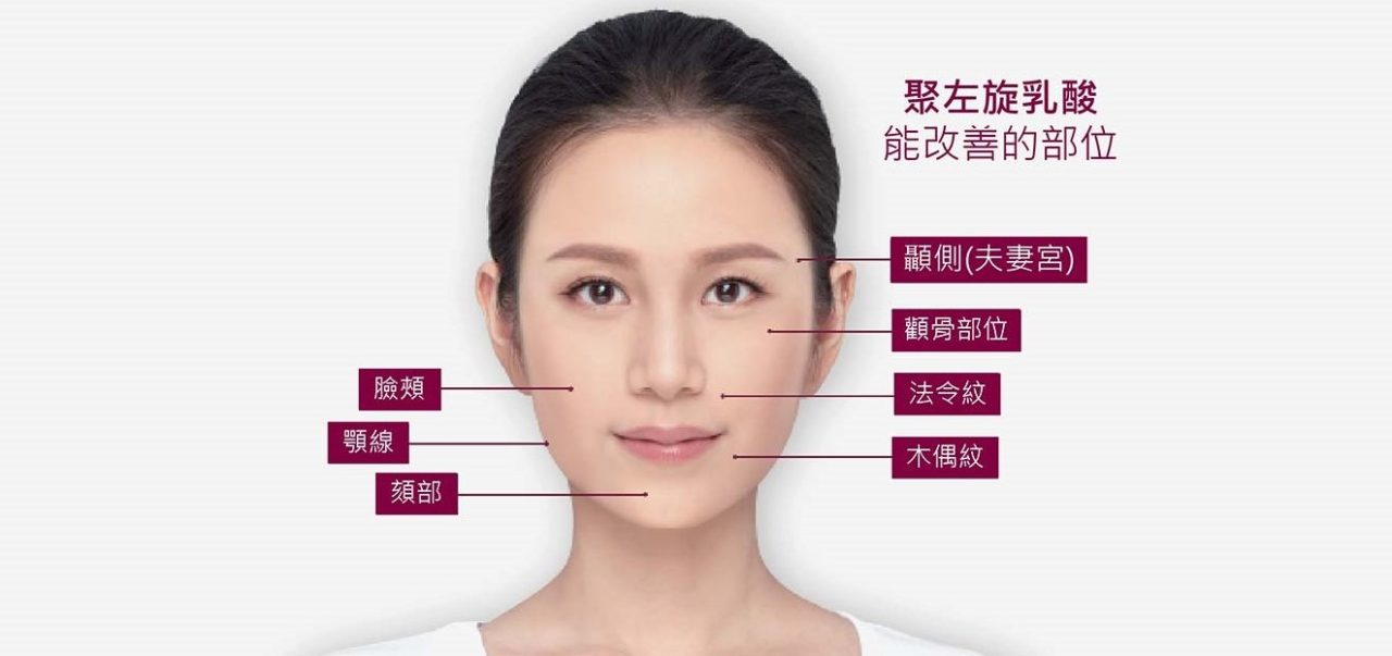 4D舒顏萃可應用於-夫妻宮、顴骨、法令紋、木偶紋、臉部輪廓雕塑、顎部輪廓雕塑