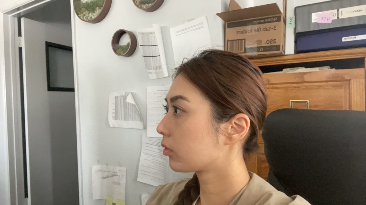 解決連婚秘都認證過難遮瑕的眼袋！結構式眼袋手術讓我瞬間變年輕