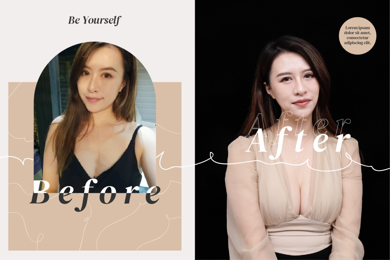 享瘦胸部也跟著瘦，柔滴隆乳解決小胸女彎腰必走光的窘境