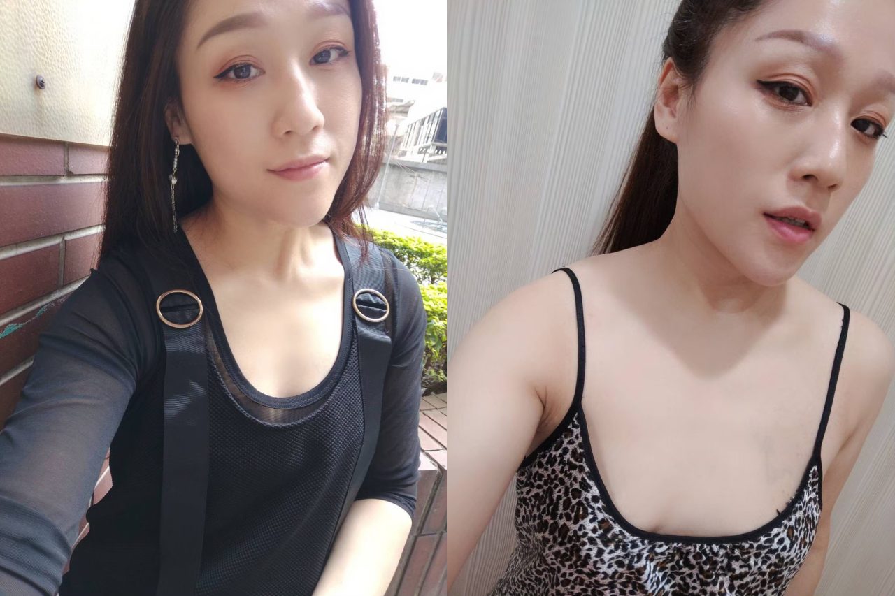 產後胸部萎縮的困擾，柔滴隆乳幫我解決下垂平胸問題
