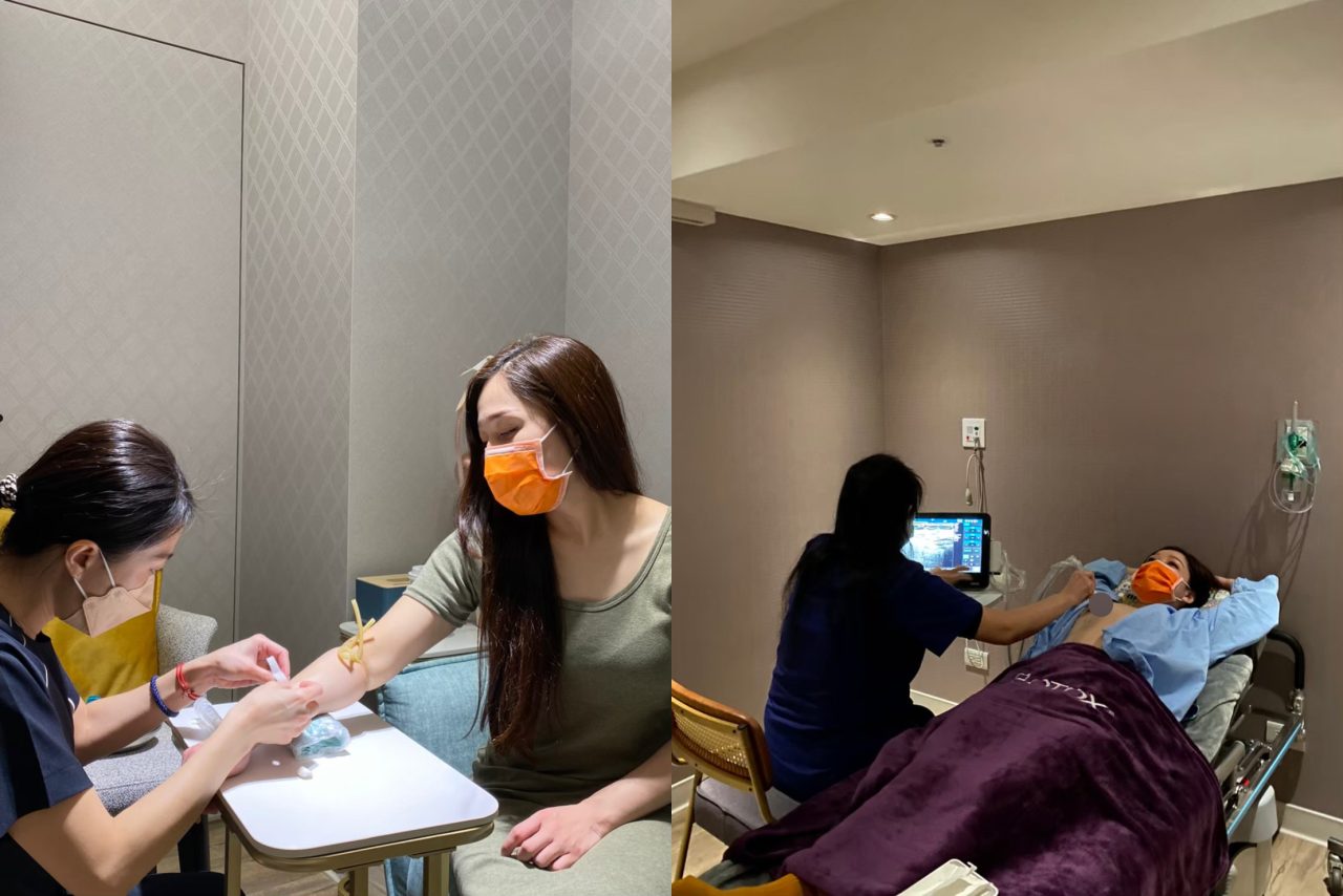 產後胸部萎縮的困擾，柔滴隆乳幫我解決下垂平胸問題