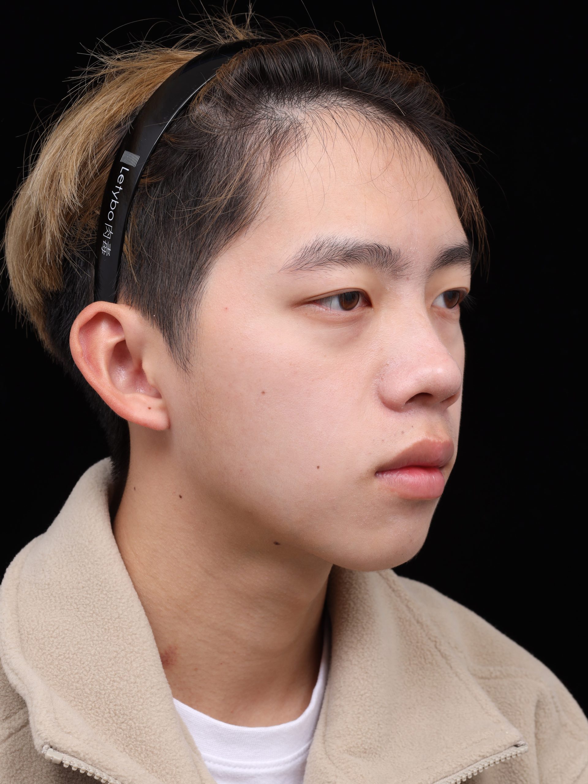After