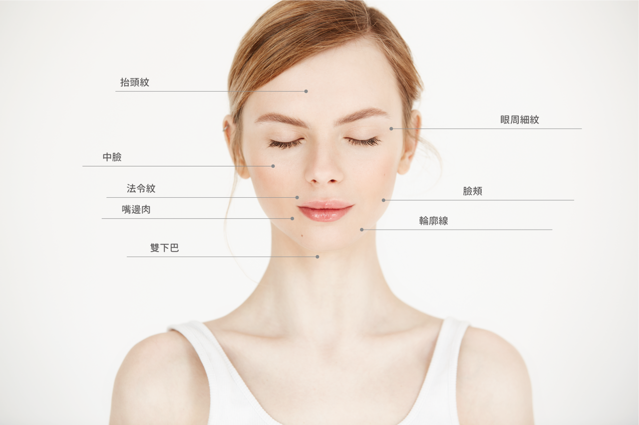 Liftera 2 音波治療臉部分區圖，標示抬頭紋、眼周細紋、中臉、法令紋、嘴角肉、顴頰、輪廓線、雙下巴等可作用部位