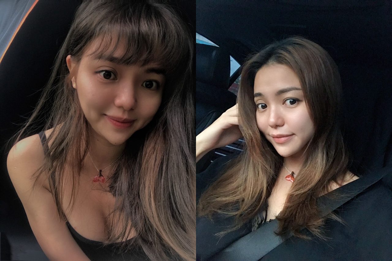 大小眼原來是因為眼窩凹陷！改善大小眼從此不再被說沒睡飽