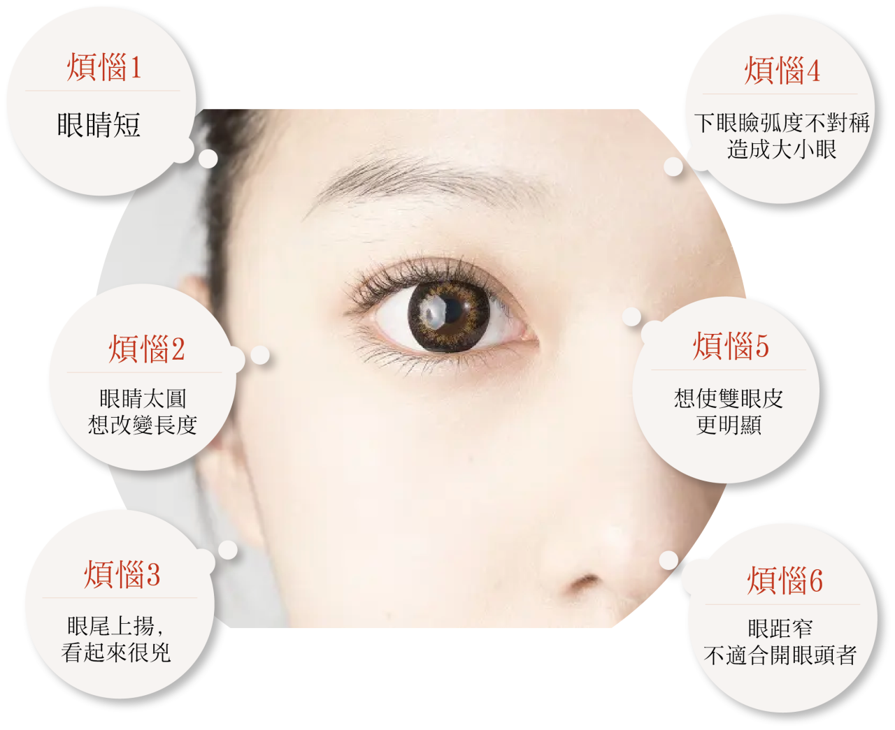 如果你也有這些煩惱，可以考慮看看進行開眼尾/眼尾下置