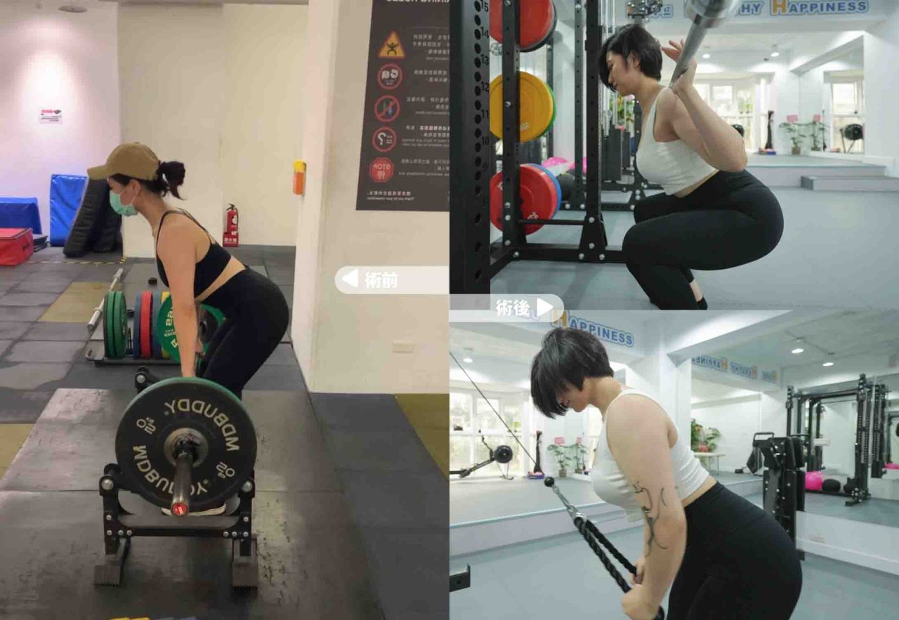 隆乳手術 術前術後案例分享 曼陀果凍矽膠