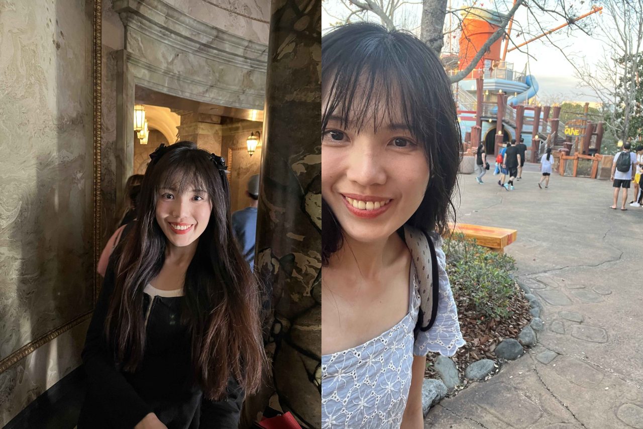 異肋+耳軟骨隆鼻打造我的韓式天生自然翹鼻！
