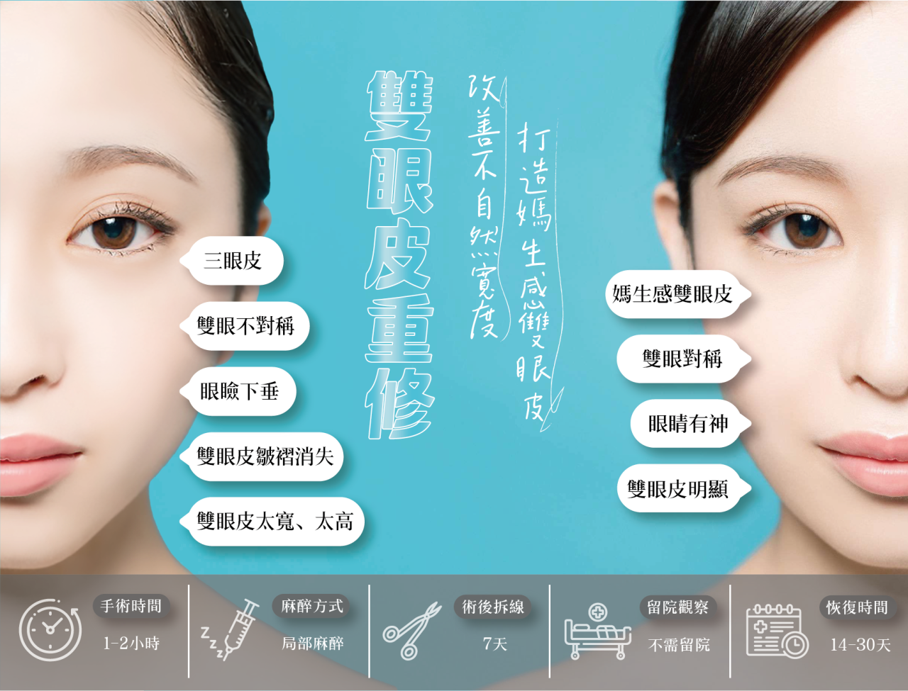 雙眼皮重修全解析:恢復期長短?改善大小眼?眼褶不對稱?