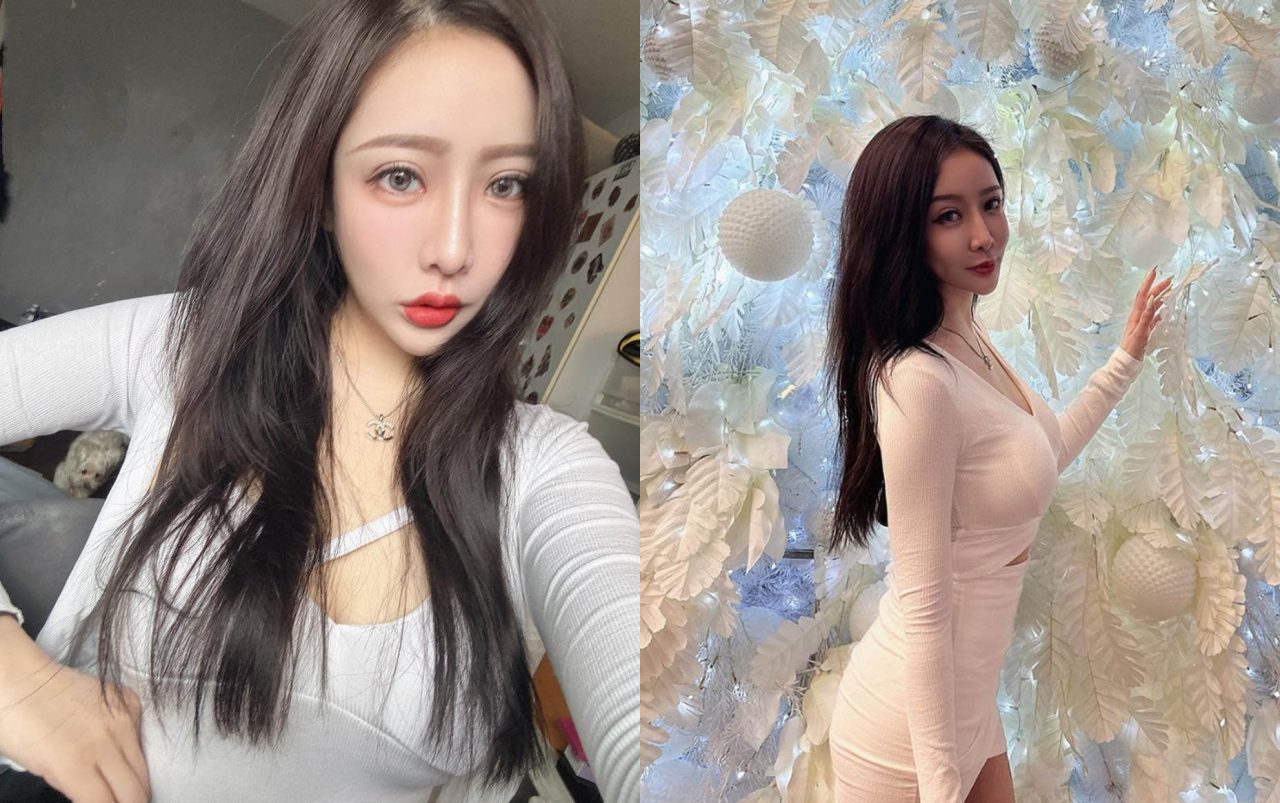 天鵝頸手術複合臉頰抽脂改善肉肉臉！我的側臉也太美!!