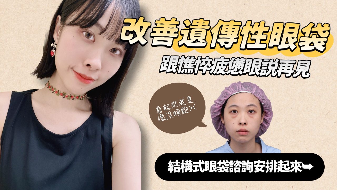 遺傳性眼袋讓我看起來老5歲，術後終於不再需要遮瑕！
