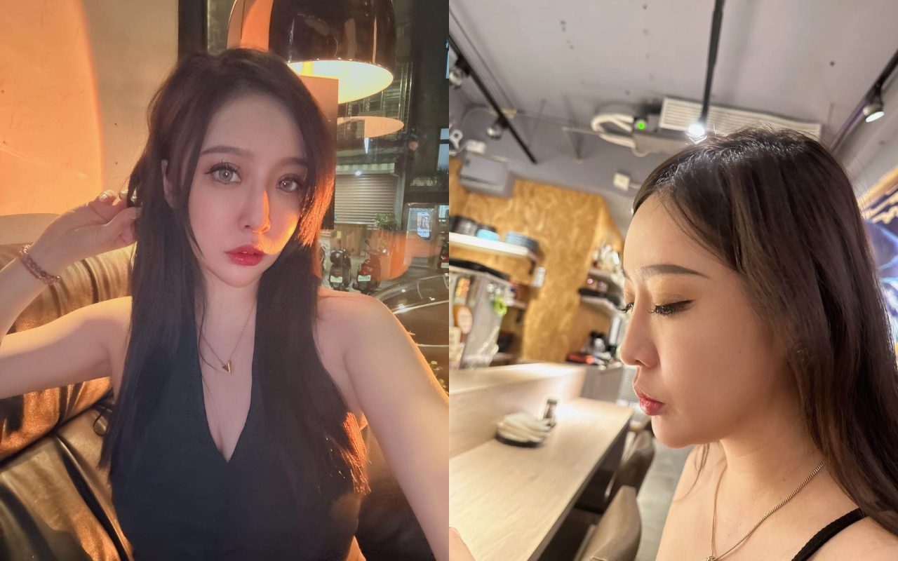 天鵝頸手術複合臉頰抽脂改善肉肉臉！我的側臉也太美!!