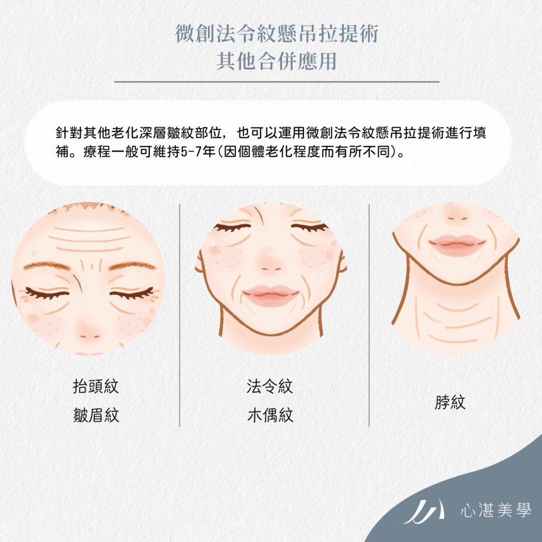 針刀手法可以運用在其他深紋、皺紋上嗎？