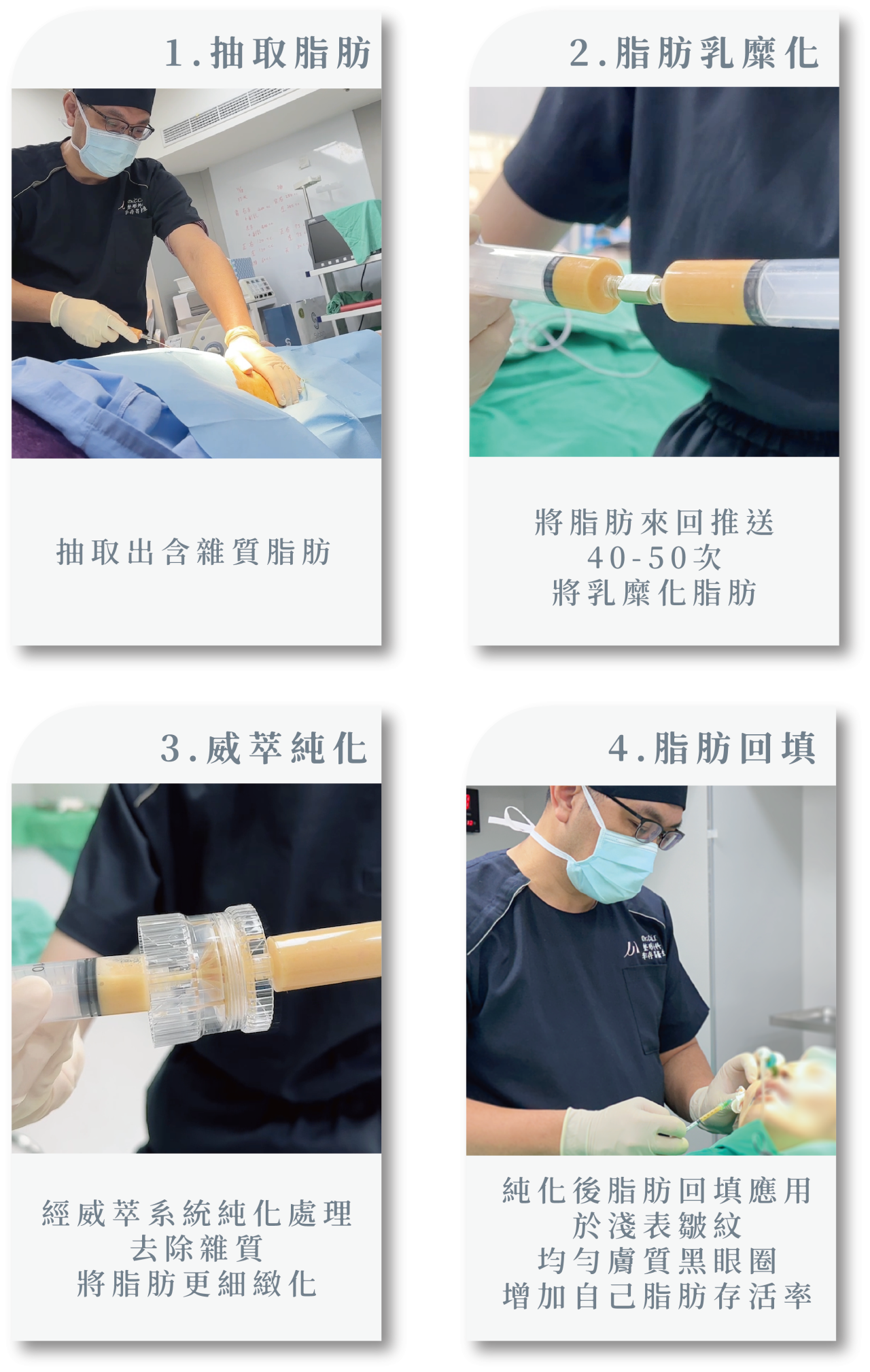 威萃脂肪溶液的使用步驟是：先抽脂，接著將脂肪與威萃混合，最後透過離心，分離出高品質的純脂肪進行回填。