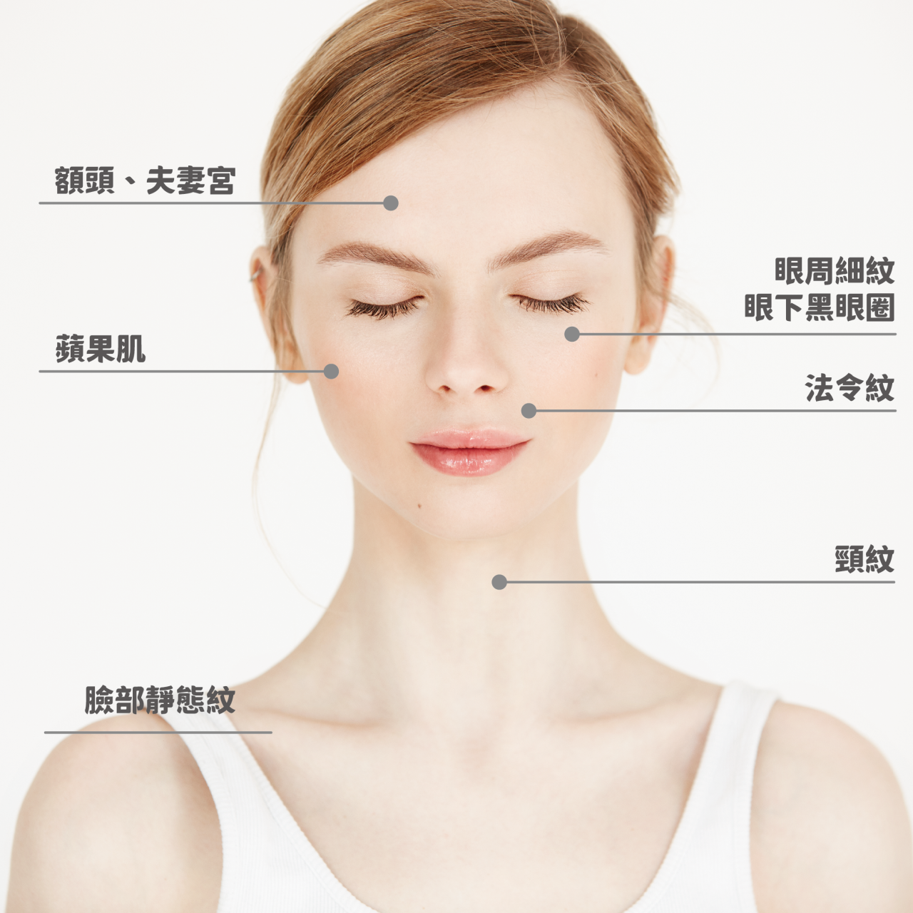 自體脂肪回填範圍：額頭、法令紋、眼周、太陽穴、蘋果肌、下巴等部位。