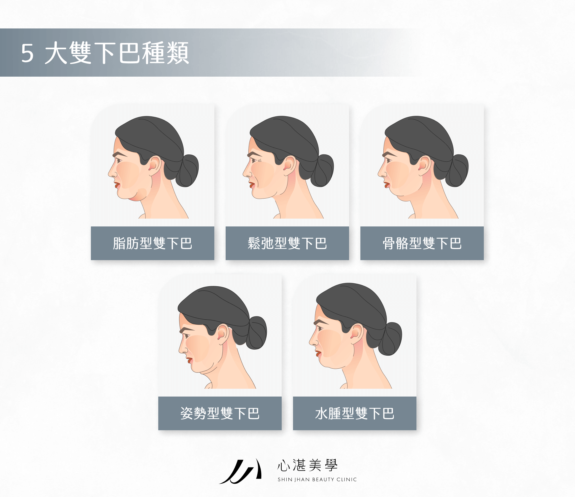 5 大雙下巴種類