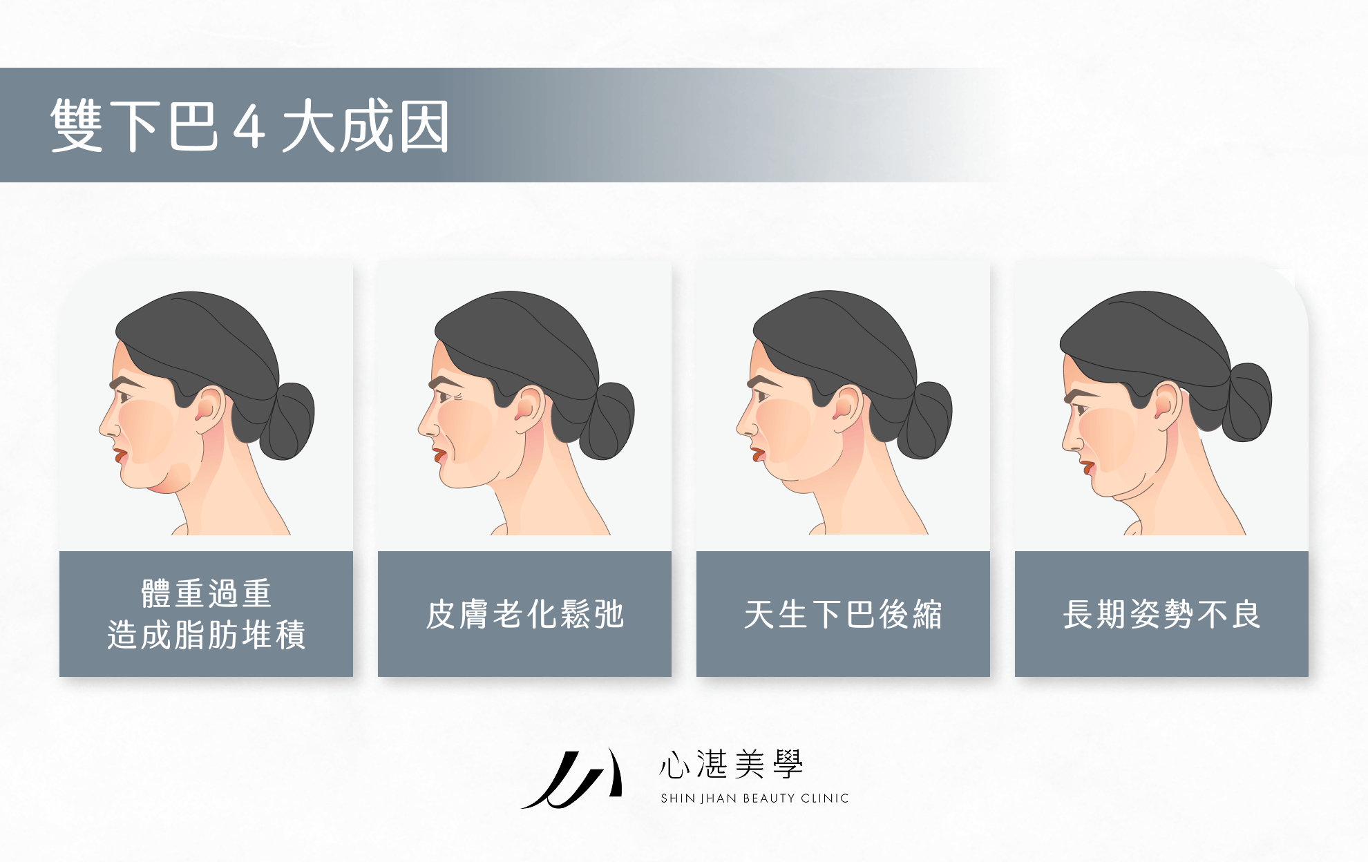 雙下巴 4 大成因