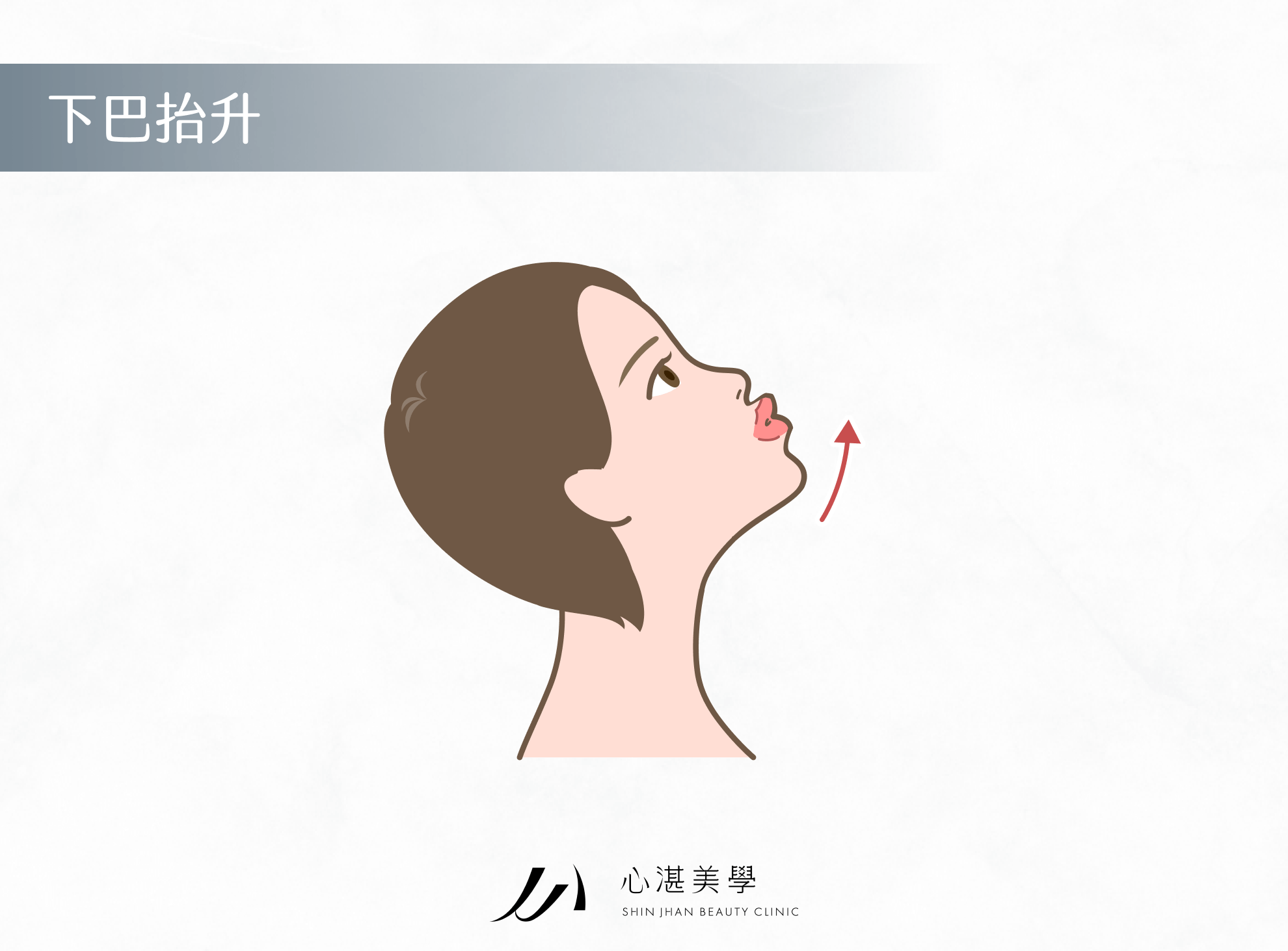 下巴抬升