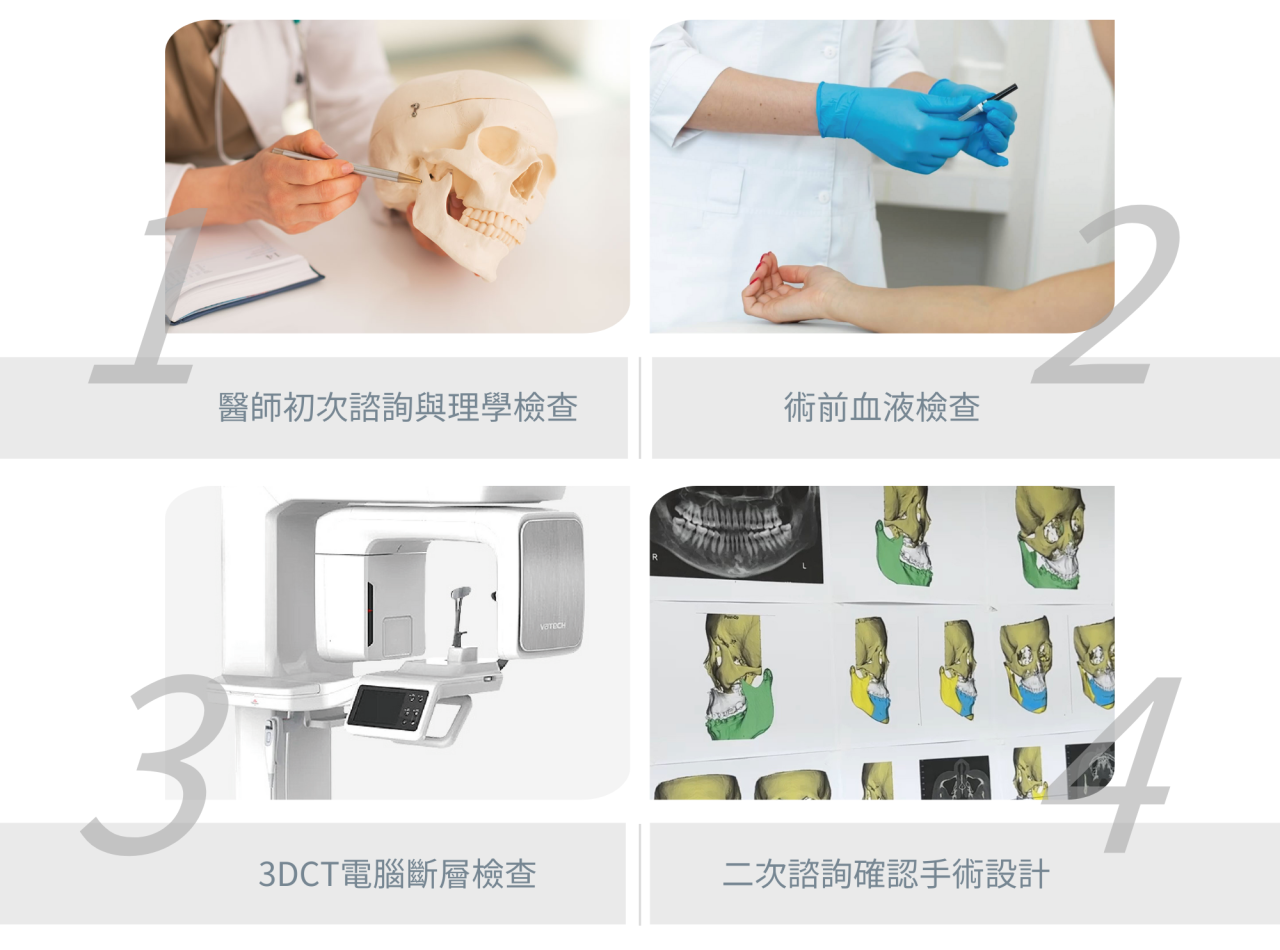 手術前，醫師會進行初次諮詢與理學檢查，了解病史及評估臉部。接著是術前血液檢查，確保身體狀況適合。然後進行3DCT電腦斷層掃描，精準分析骨骼結構並規劃客製化手術。最後會二次諮詢，確認手術細節與患者期望，並簽署同意書。