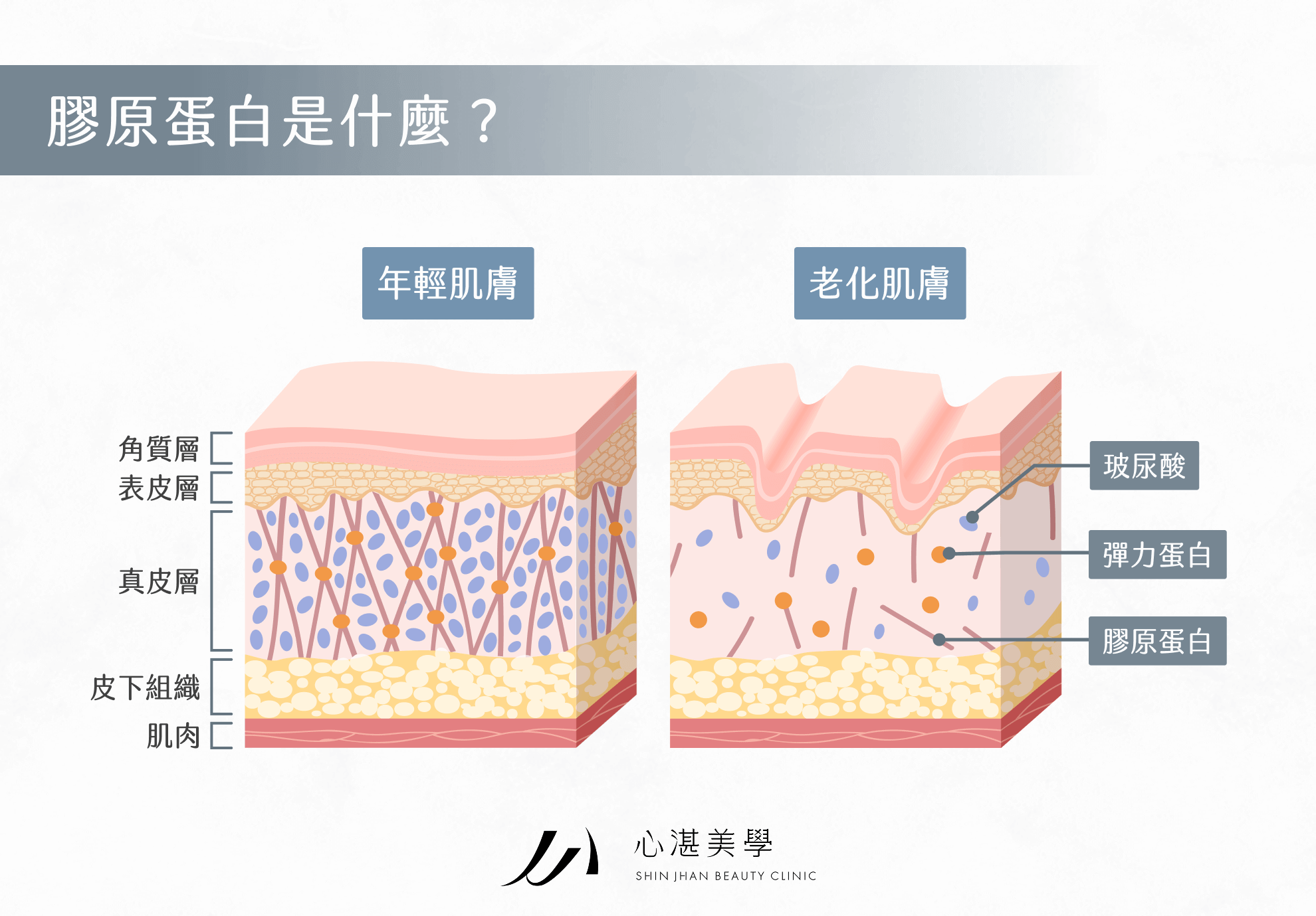 膠原蛋白是什麼？