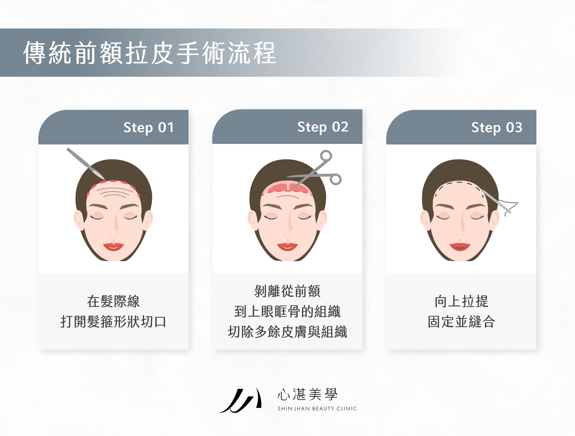 傳統前額拉皮手術流程