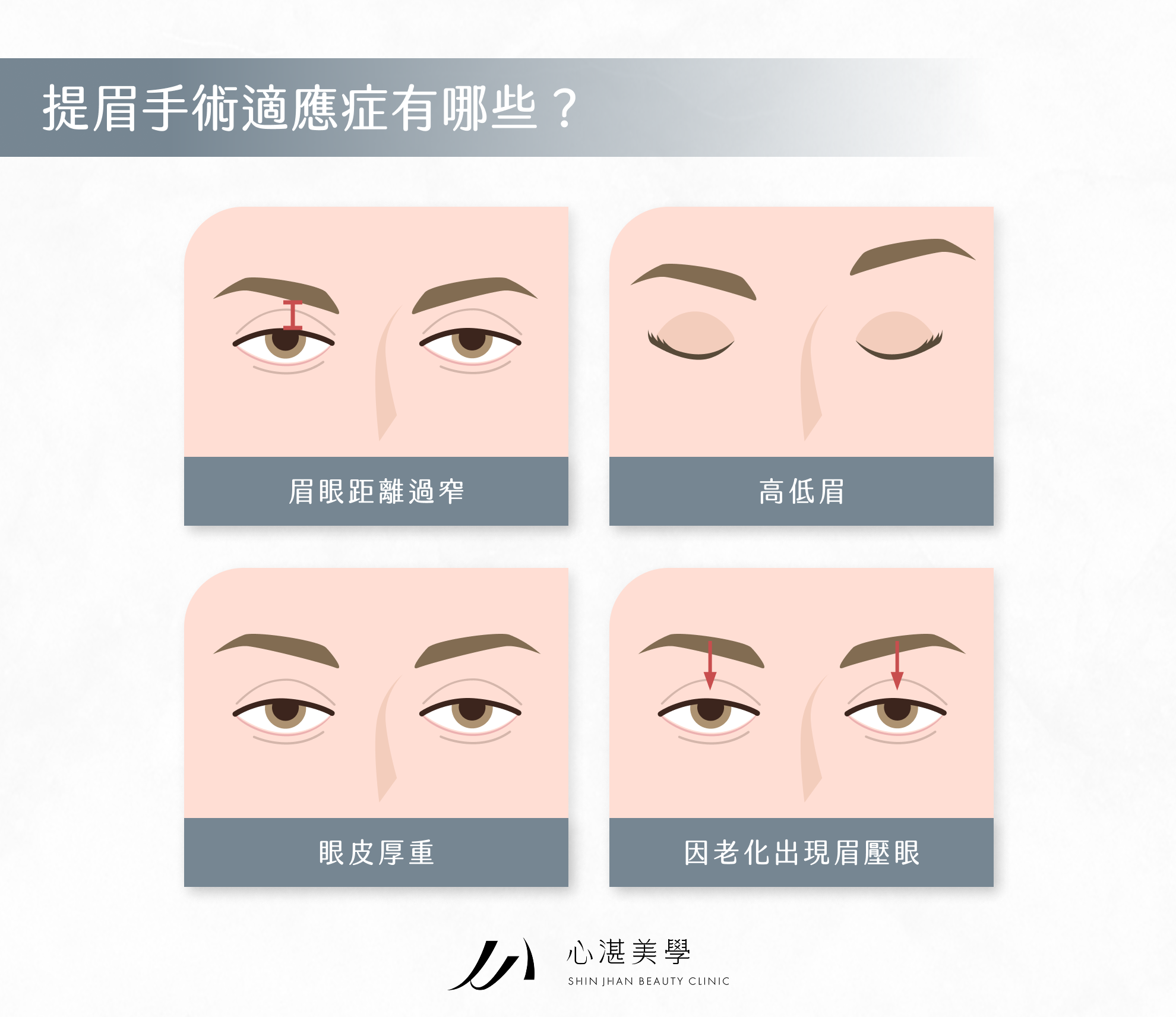 提眉手術適應症有哪些？