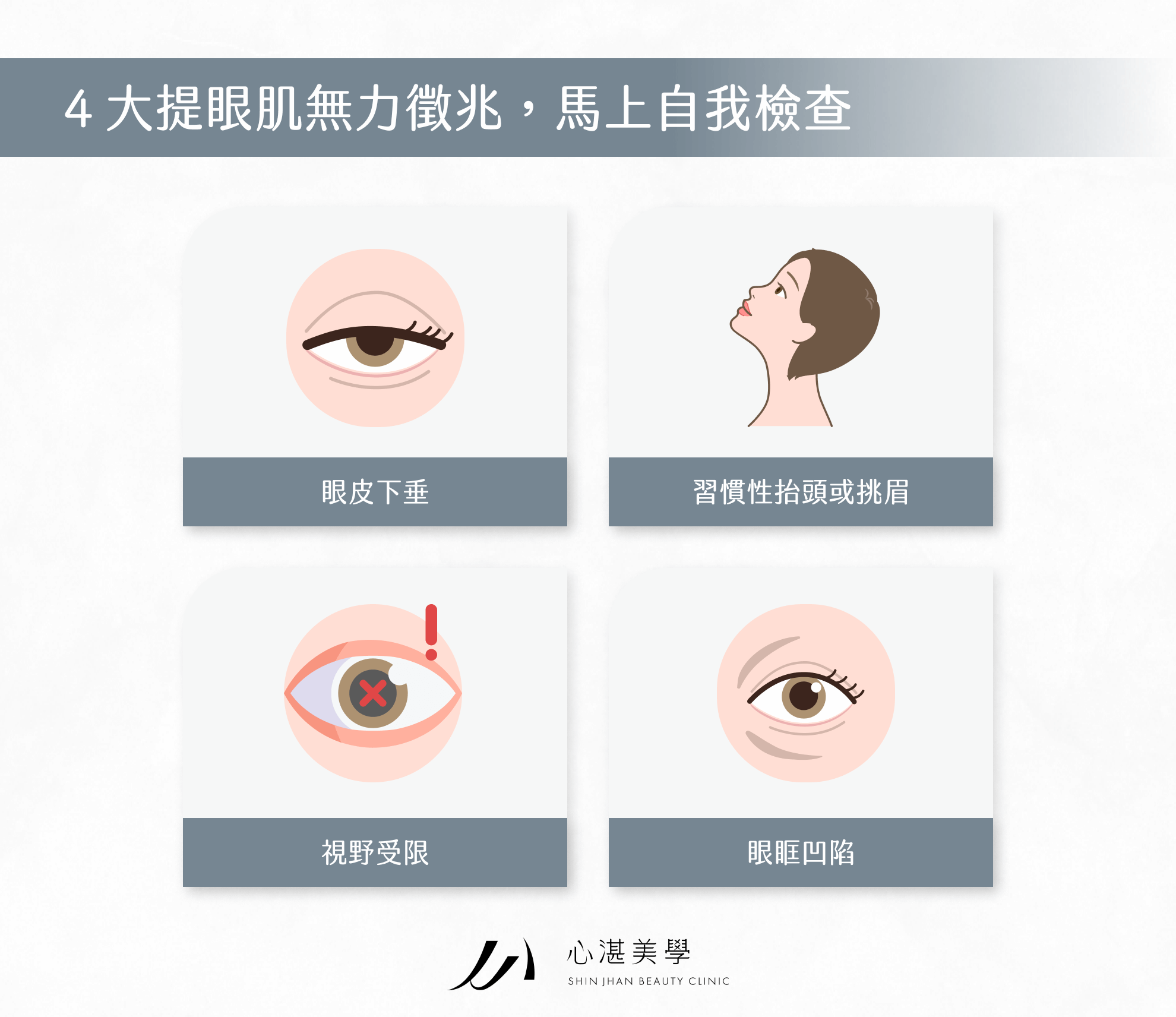 4 大提眼肌無力徵兆