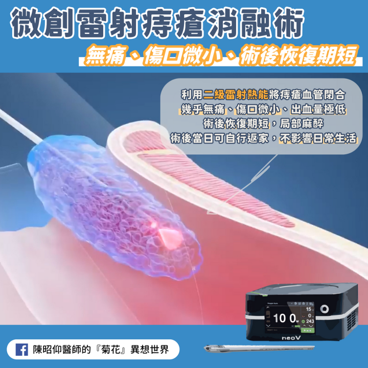 用雷射傷口比較小？微創痔瘡手術雷射痔瘡消融術是什麼？