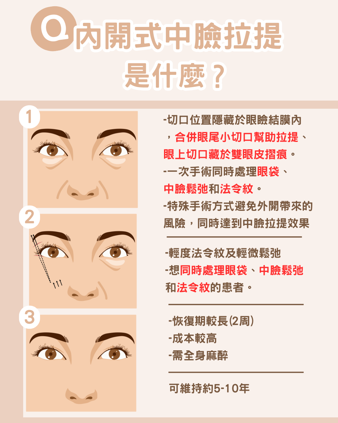 眼袋嚴重怎麼辦？內開式中臉拉提讓你年輕10歲！