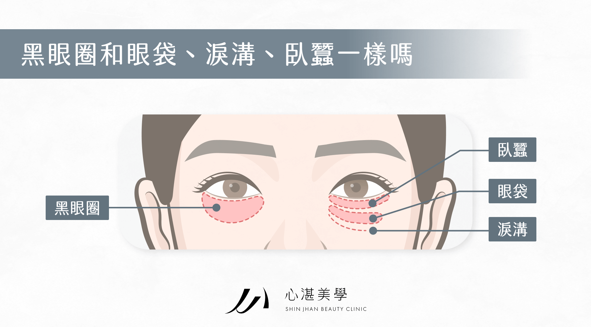 黑眼圈和眼袋、淚溝、臥蠶一樣嗎