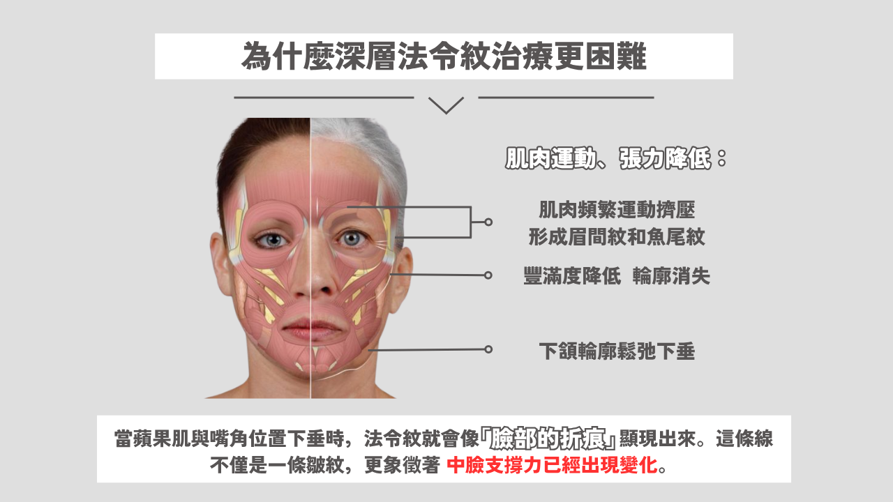 為什麼深層法令紋治療更困難?