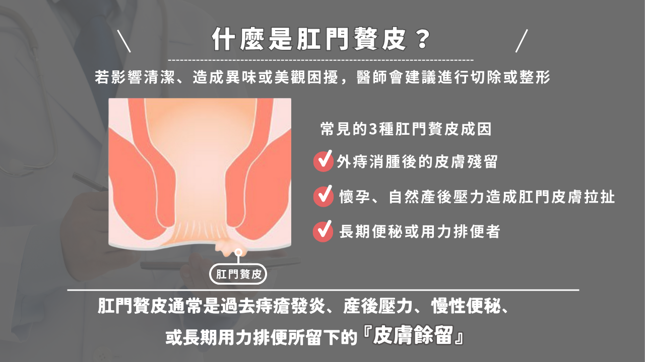 什麼是肛門贅皮?以及常見的3種肛門贅皮成因?