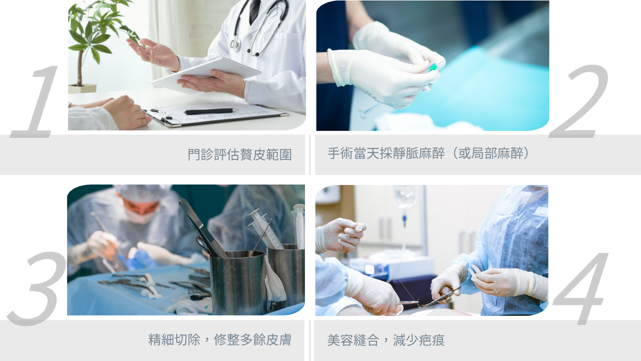 肛門贅皮整形手術流程