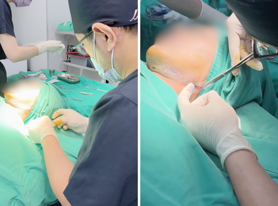 Mint神力拉提療程過程提供您安心的諮詢、精準無菌環境下的治療,以及完善的術後追蹤服務。