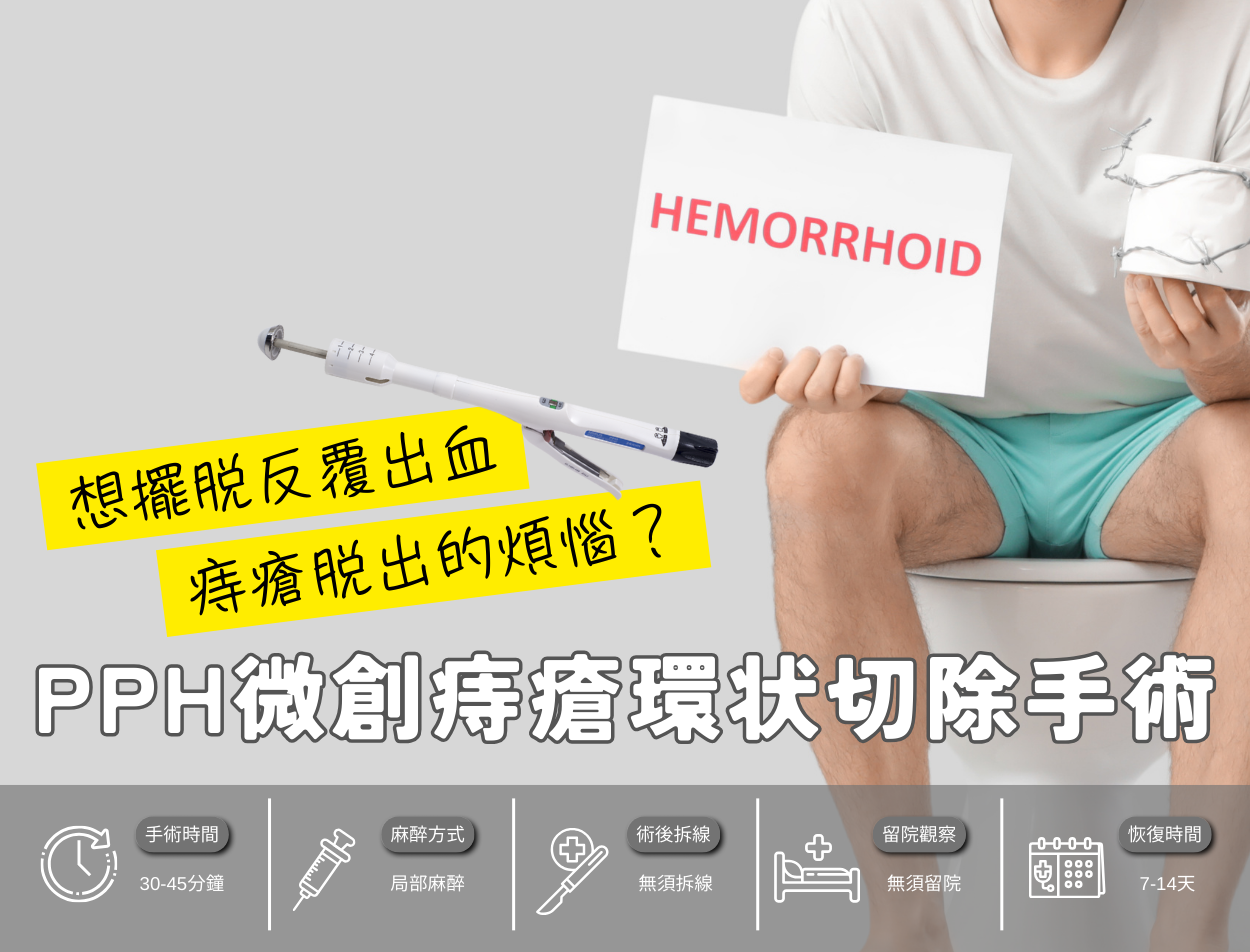 PPH微創痔瘡環狀切除手術|一次看懂環狀切除手術原理與優勢