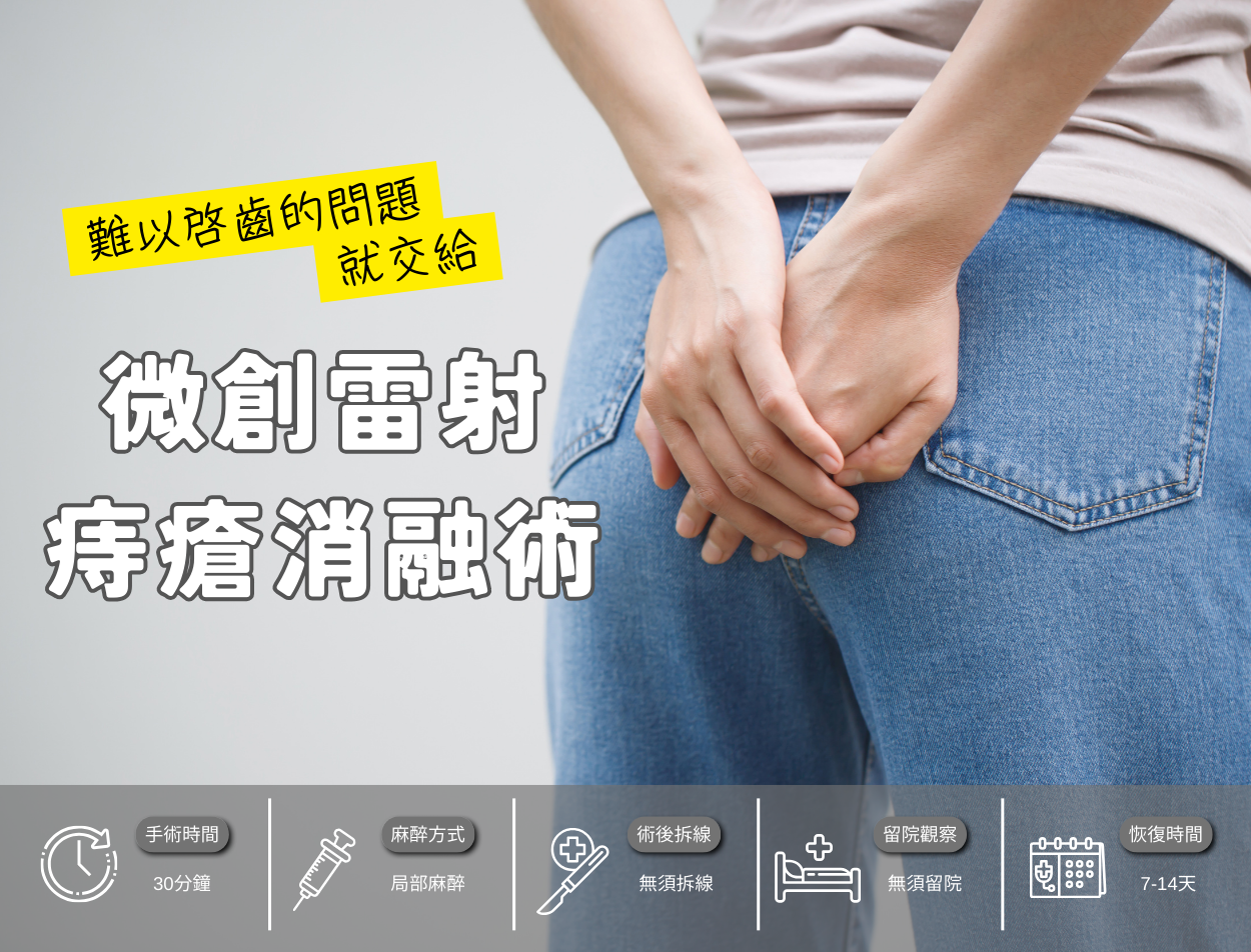 微創雷射痔瘡消融術|低疼痛、恢復期短