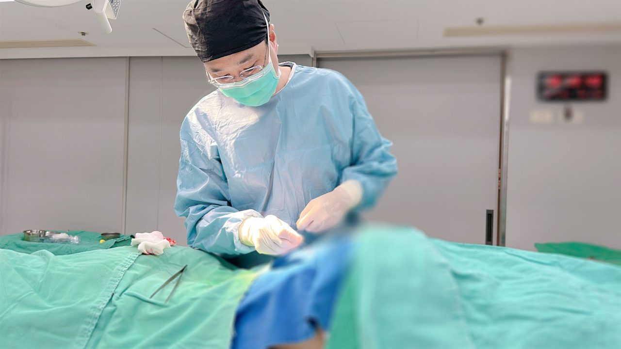 肛門贅皮切除會痛嗎？一次看懂手術流程、恢復期與疤痕問題