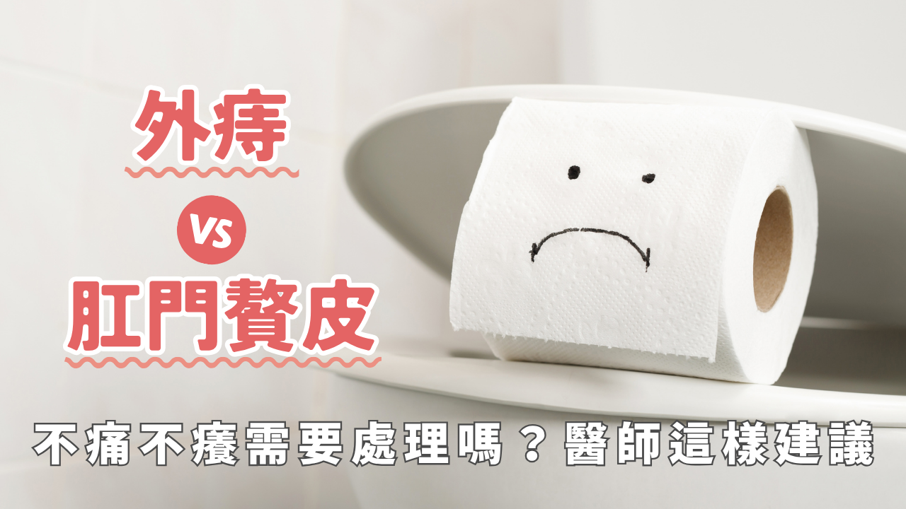 外痔 vs 肛門贅皮不痛不癢需要處理嗎?醫師這樣建議