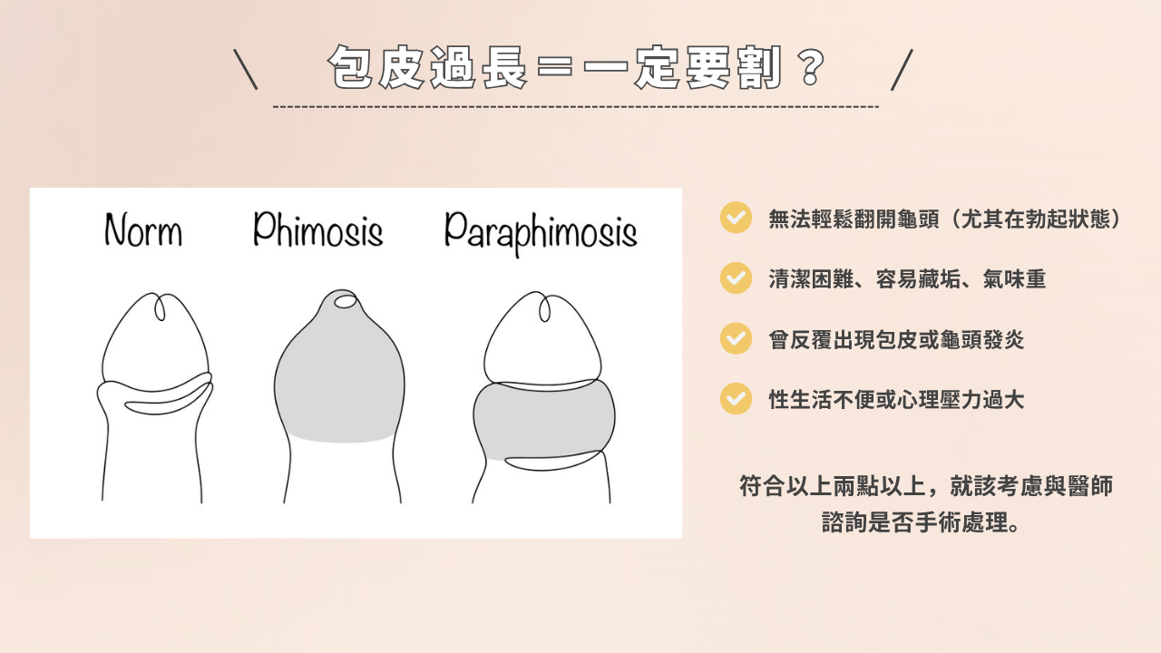 包皮過長是否需要割包皮？說明正常、包莖、嵌頓性包莖的差異，列出割包皮評估依據與症狀判斷標準