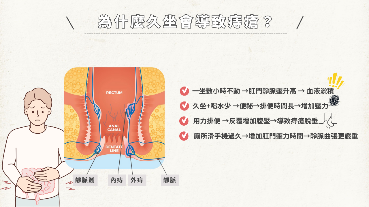 久坐導致痔瘡原因解剖圖 - 顯示直腸與內外痔位置 肛門周圍有一圈血管組織（俗稱肛門靜脈叢），當你長時間維持坐姿、肛門受壓、血流循環變差時，這些血管就會腫脹、鬆弛甚至脫垂，成為內痔或外痔。
