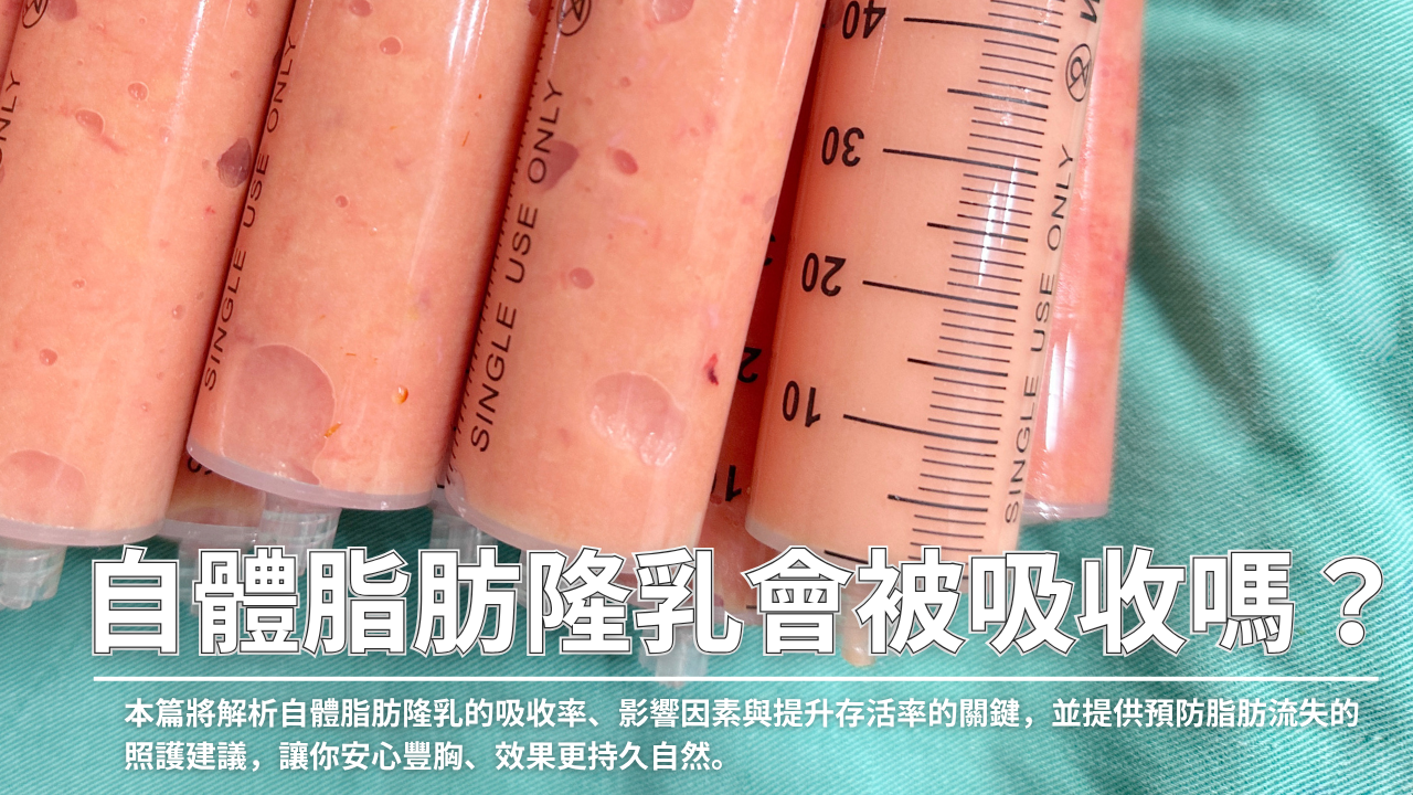 自體脂肪隆乳真的會被吸收嗎?術後胸型會消失嗎?本篇將解析自體脂肪隆乳的吸收率、影響因素與提升存活率的關鍵,並提供預防脂肪流失的照護建議,讓你安心豐胸、效果更持久自然。