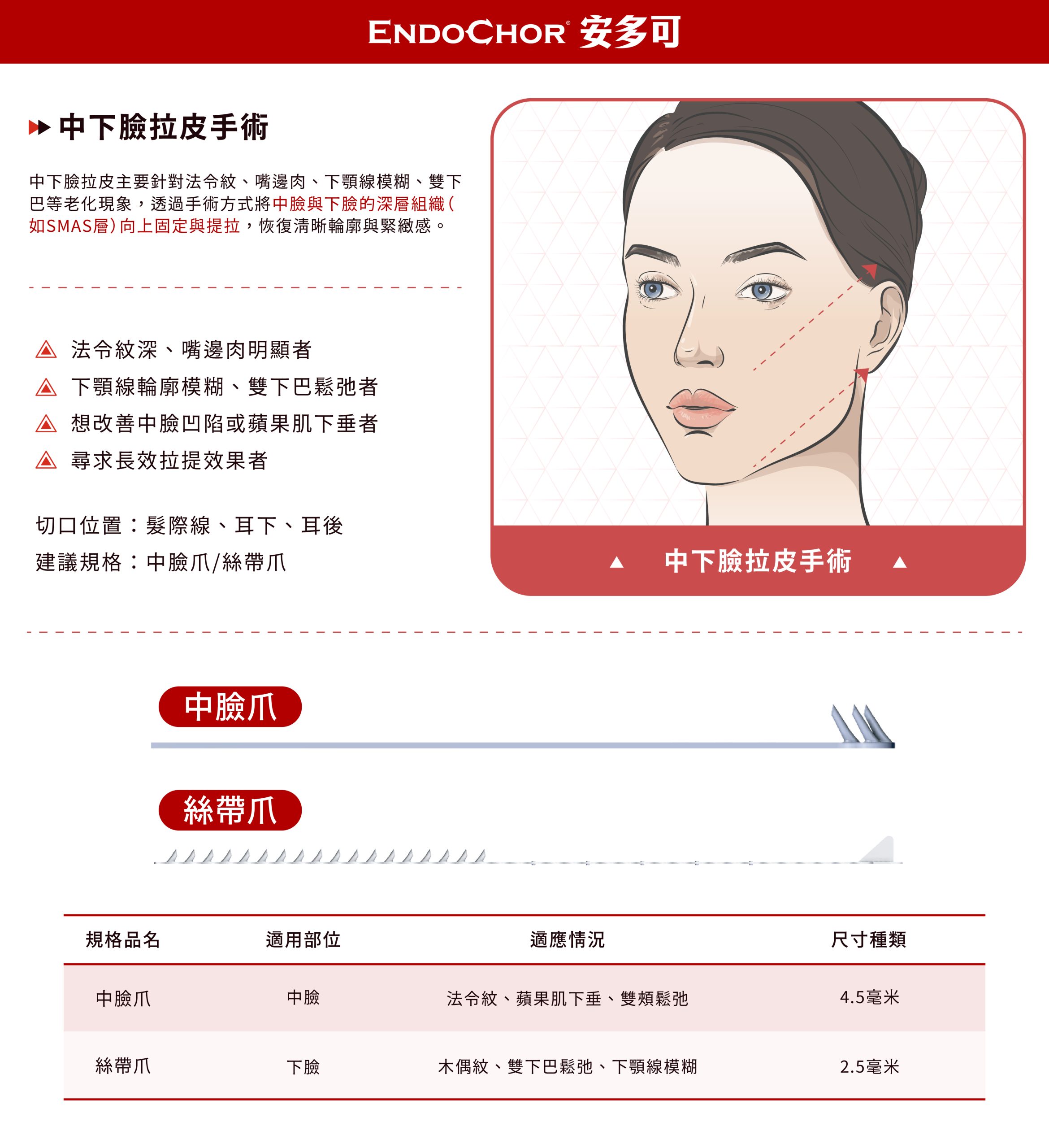 EndoChor安多可中下臉拉皮手術示意圖,顯示如何使用中臉爪與綠帶爪改善法令紋與下顎線鬆弛問題,並列出適用部位與尺寸。