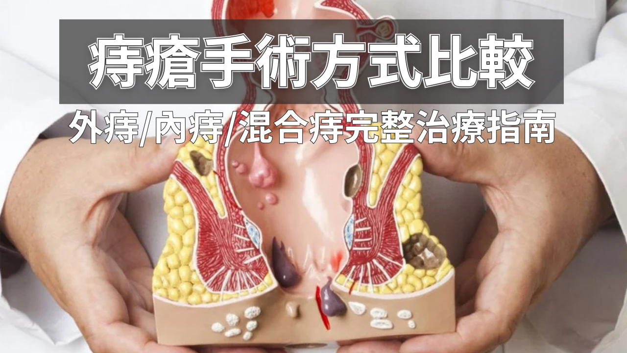 您正在尋找專業的「痔瘡手術方式比較」嗎？台北心湛美學診所的陳昭仰醫師，為您權威解析內痔、外痔、混合痔的治療差異。我們提供適合上班族與產後媽媽的微創痔瘡手術方案，助您告別難言之隱，在台北輕鬆完成治療，快速恢復舒適生活。
