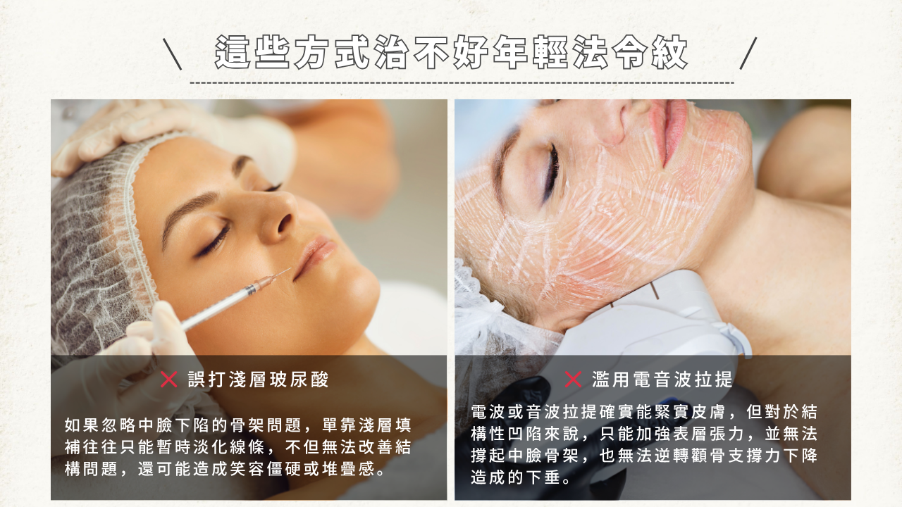 兩張圖片說明無效的治療方式。左圖為注射淺層玻尿酸，文字說明此法無法改善結構問題。右圖為使用電音波拉提，文字說明此法只能加強表層張力，無法提起中臉骨架。標題為「這些方式治不好年輕法令紋」。