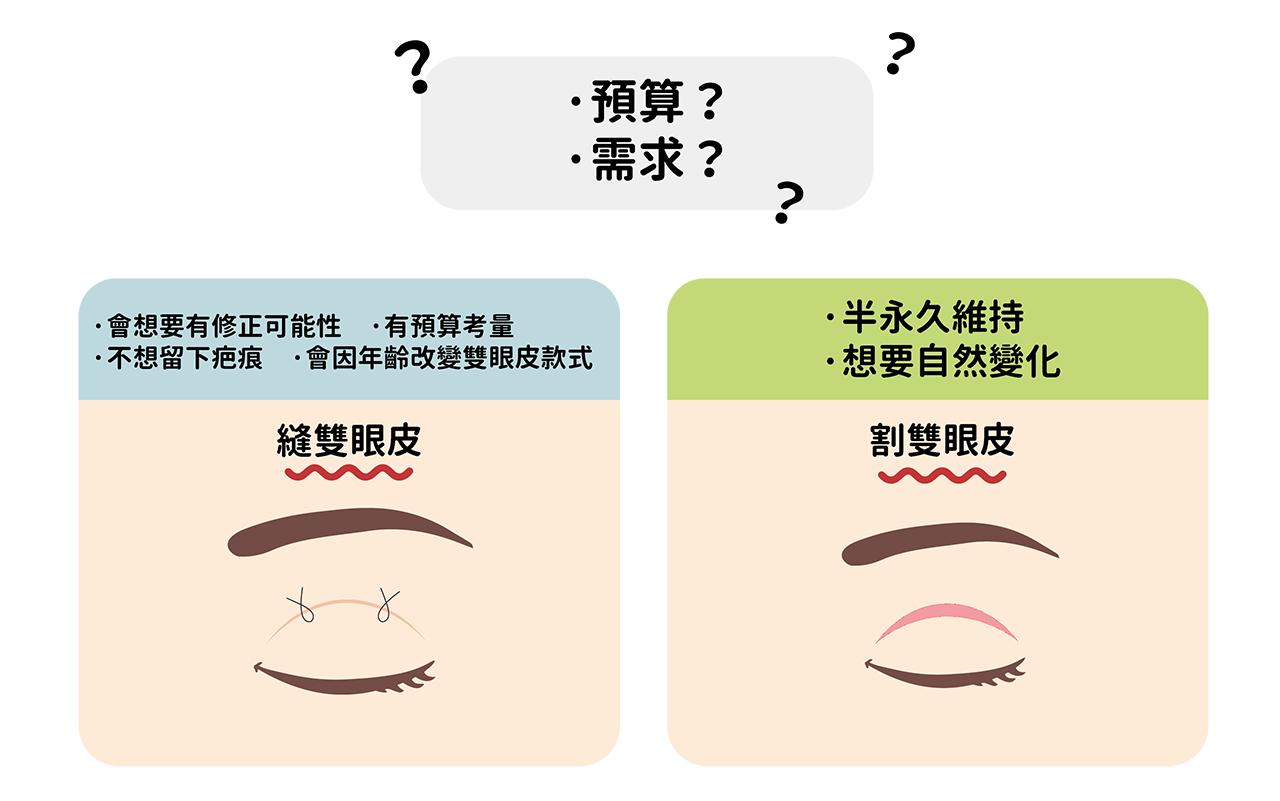 割雙眼皮/縫雙眼皮我該如何選擇?先從預算與你的需求看起!