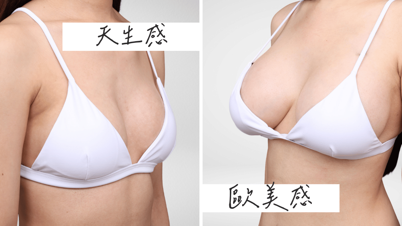 觸感與形狀：妳喜歡隆乳後「天生感」自然，還是隆乳後「歐美感」飽滿？