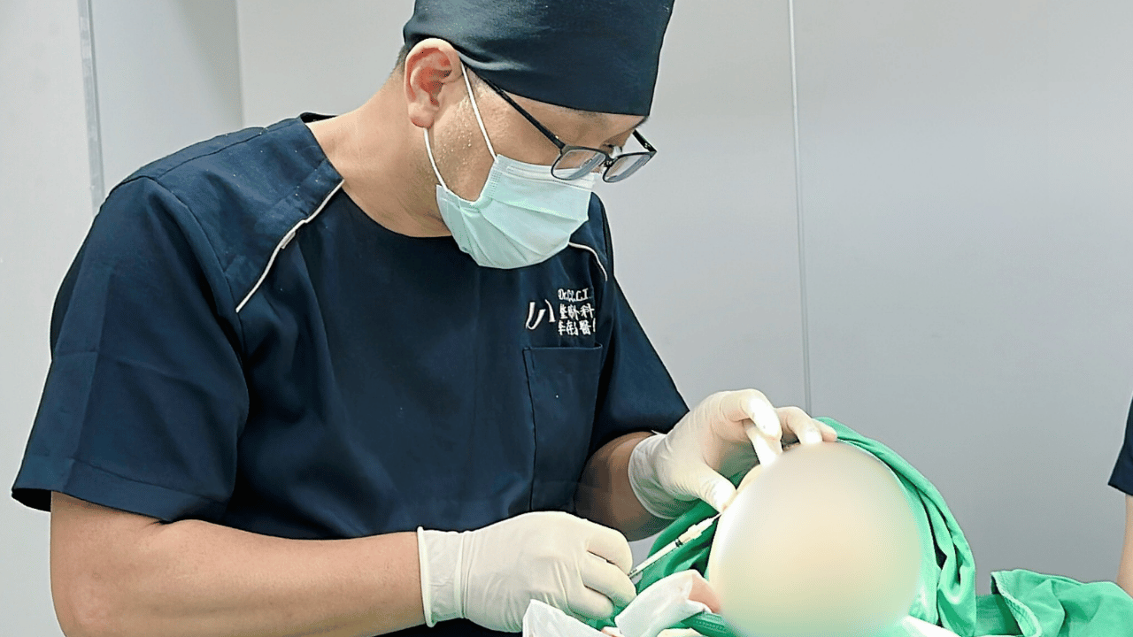 李存昌醫師觀點：脂肪轉位＋奈米脂肪填補，更精準的客製化方案