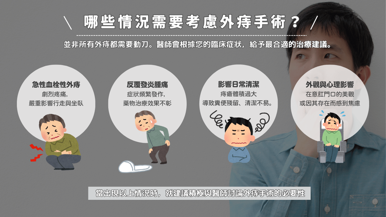 哪些情況需要考慮外痔手術？