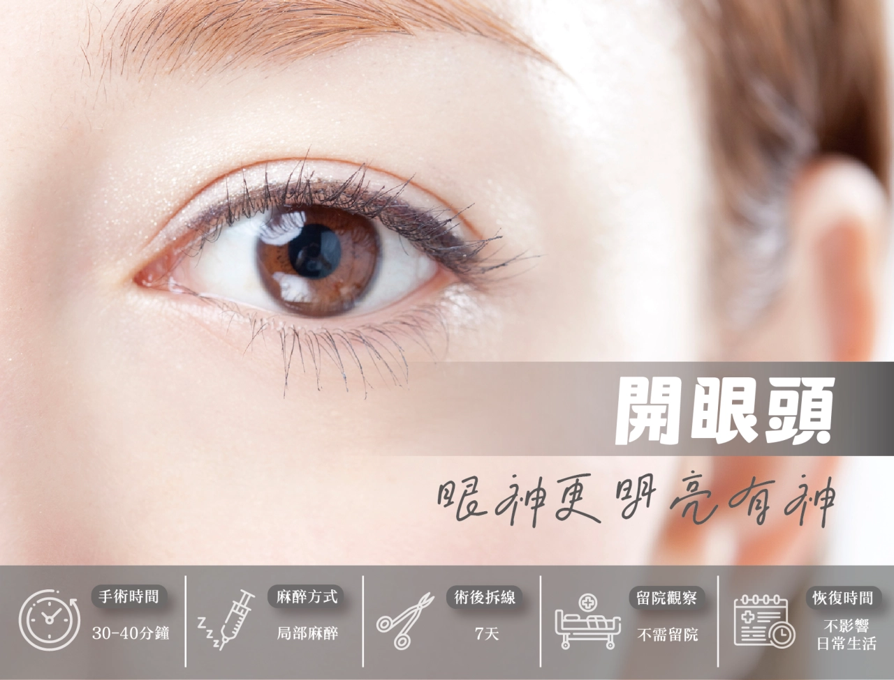 開眼頭手術－改善蒙古褶，讓雙眼更明亮